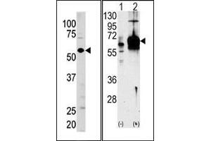 Image no. 2 for anti-Guanylate Cyclase 1 Soluble Subunit Alpha (GUCY1A1) (N-Term) antibody (ABIN359277)