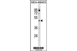 Image no. 1 for anti-Opioid Receptor, kappa 1 (OPRK1) (AA 181-209) antibody (ABIN1881595)