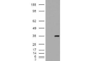 Image no. 2 for Monoglyceride Lipase (MGLL) peptide (ABIN369607)