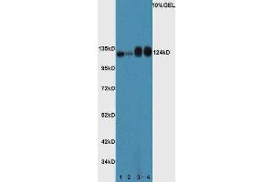 Image no. 2 for anti-Tumor Protein P53 Binding Protein 2 (TP53BP2) (AA 1001-1128) antibody (ABIN674394)