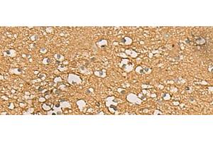 Immunohistochemistry of paraffin-embedded Human brain tissue using ENO3 Polyclonal Antibody at dilution of 1:70(x200)