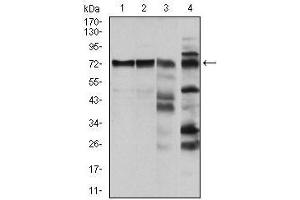 Image no. 2 for anti-V-Raf-1 Murine Leukemia Viral Oncogene Homolog 1 (RAF1) antibody (ABIN969559)