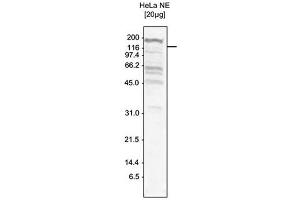 Image no. 3 for anti-Tetratricopeptide Repeat Domain 37 (TTC37) antibody (ABIN6655651)