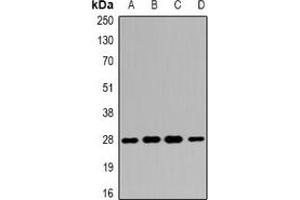 Image no. 3 for anti-14-3-3 alpha + beta (YWHAB) antibody (ABIN3197851)
