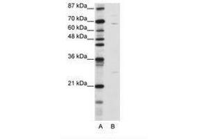 Image no. 2 for anti-Kelch-Like 13 (KLHL13) (N-Term) antibody (ABIN6736185)