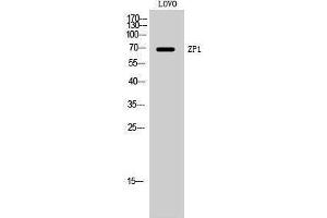 Image no. 1 for anti-Zona Pellucida Glycoprotein 1 (ZP1) (Internal Region) antibody (ABIN3187575)