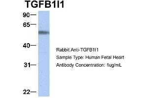Image no. 5 for anti-Transforming Growth Factor beta 1 Induced Transcript 1 (TGFB1I1) (Middle Region) antibody (ABIN2777947)