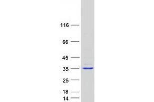 TTC33 Protein (Myc-DYKDDDDK Tag)