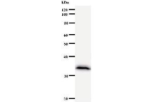 Image no. 1 for anti-Calcium And Integrin Binding Family Member 2 (CIB2) antibody (ABIN930952)