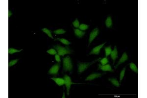 Immunofluorescence of purified MaxPab antibody to WTIP on HeLa cell.