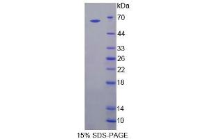 Image no. 1 for Bestrophin 1 (BEST1) (AA 292-585) protein (GST tag,His tag) (ABIN6239158)