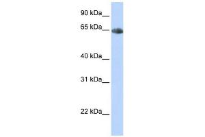 Image no. 1 for anti-Solute Carrier Family 6 (Neurotransmitter Transporter, Noradrenalin), Member 2 (SLC6A2) antibody (ABIN635638)