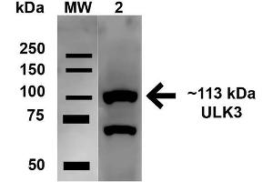Image no. 2 for anti-Unc-51 Like Kinase 2 (ULK2) (AA 558-569) antibody (Alkaline Phosphatase (AP)) (ABIN5066164)