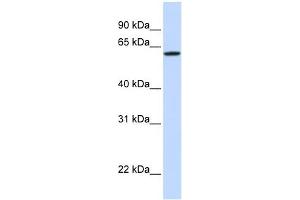Image no. 1 for anti-DiGeorge Syndrome Chromosome Region-2 (DGS2) (Middle Region) antibody (ABIN634699)