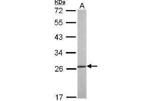 Image no. 1 for anti-Heat Shock 27kDa Protein 1 (HSPB1) (Center) antibody (ABIN2854951)