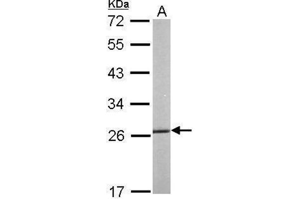 anti-Heat Shock 27kDa Protein 1 (HSPB1) (Center) antibody