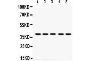 Image no. 1 for anti-Tropomyosin 1 (Alpha) (TPM1) antibody (ABIN3043110)