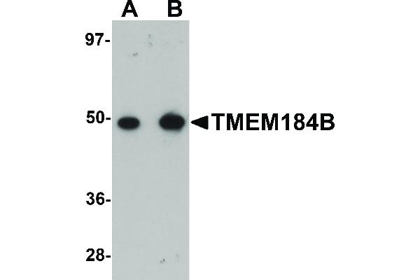 TMEM184B 抗体  (C-Term)
