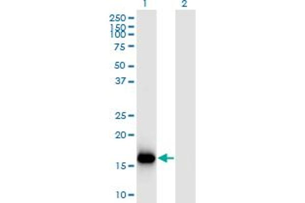 anti-Basic Leucine Zipper Transcriptional Factor ATF-Like 3 (BATF3) (AA 1-127) antibody