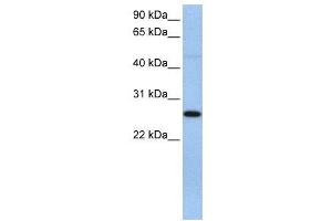 Image no. 2 for anti-Eukaryotic Translation Initiation Factor 4H (EIF4H) (C-Term) antibody (ABIN2776553)