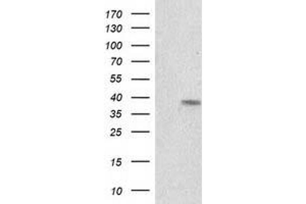 anti-Retinol Dehydrogenase 14 (All-Trans/9-Cis/11-Cis) (RDH14) antibody