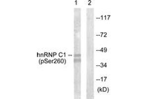 Western blot analysis of extracts from 293 cells treated with H2O2 100uM 15', using hnRNP C1/2 (Phospho-Ser260) Antibody.