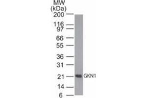 Image no. 1 for anti-Gastrokine 1 (GKN1) (AA 100-150) antibody (ABIN960186)