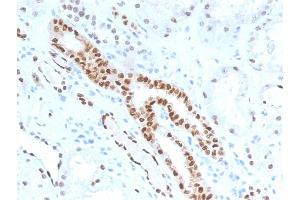 Image no. 3 for anti-Paired Box 8 (PAX8) (AA 60-261) antibody (ABIN6940923)