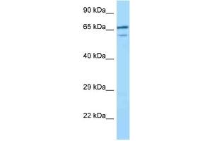 Image no. 1 for anti-Villin-Like (VILL) (C-Term) antibody (ABIN2789508)