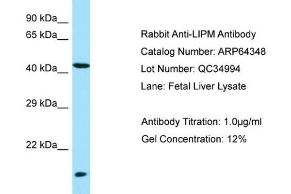 LIPM 抗体  (N-Term)