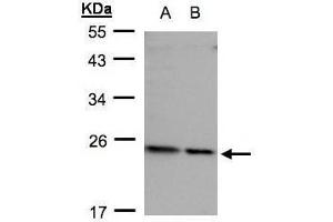 WB Image Sample(30 ug whole cell lysate) A: HeLa S3, B: Hep G2, 12% SDS PAGE diluted at 1:500