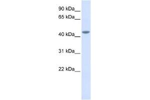 Image no. 1 for anti-Interleukin 11 Receptor, alpha (IL11RA) (Middle Region) antibody (ABIN635795)