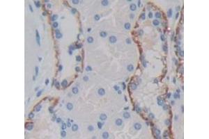 Image no. 2 for anti-Interleukin 18 Receptor Accessory Protein (IL18RAP) (AA 310-451) antibody (ABIN1862748)