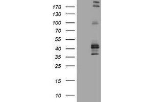 Image no. 2 for anti-Fc Fragment of IgE, Low Affinity II, Receptor For (CD23) (FCER2) (AA 48-321) antibody (ABIN1491554)