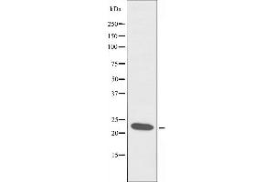 Image no. 1 for anti-Cell Death-Inducing DFFA-Like Effector B (CIDEB) antibody (ABIN6258021)