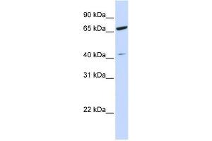 anti-Zinc Finger Protein 334 (ZNF334) (N-Term) antibody