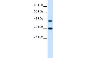 Image no. 1 for anti-D4, Zinc and Double PHD Fingers Family 1 (DPF1) (Middle Region) antibody (ABIN2775774)