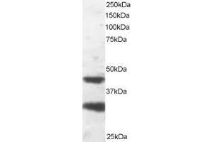 Image no. 2 for anti-Platelet-Activating Factor Acetylhydrolase 1b, Regulatory Subunit 1 (45kDa) (PAFAH1B1) (C-Term) antibody (ABIN184751)