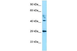 Image no. 1 for anti-Ataxia, Cerebellar, Cayman Type (ATCAY) (C-Term) antibody (ABIN2788612)