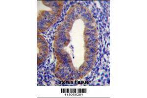 Image no. 2 for anti-FYVE, RhoGEF and PH Domain Containing 6 (FGD6) (AA 1324-1352), (C-Term) antibody (ABIN655060)