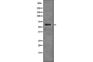 Image no. 2 for anti-Pyruvate Dehyrogenase Phosphatase Catalytic Subunit 2 (PDP2) (N-Term) antibody (ABIN6258477)