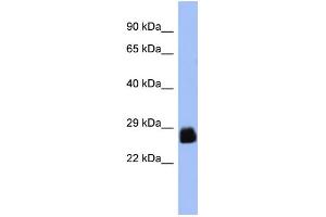 Image no. 1 for anti-Pancreatic and Duodenal Homeobox 1 (PDX1) (N-Term) antibody (ABIN2780330)