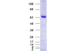Image no. 1 for Poly (ADP-Ribose) Polymerase Family, Member 3 (PARP3) (Transcript Variant 2) protein (Myc-DYKDDDDK Tag) (ABIN2728269)