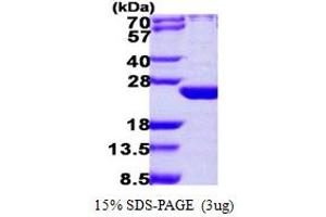 Image no. 1 for ADP Ribosylation Factor Like GTPase 6 (ARL6) (AA 1-186) protein (His tag) (ABIN667468)