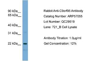 Image no. 2 for anti-Nicotinamide Riboside Kinase 1 (NMRK1) (N-Term) antibody (ABIN2787039)