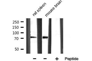 MMP 9 anticorps  (C-Term)
