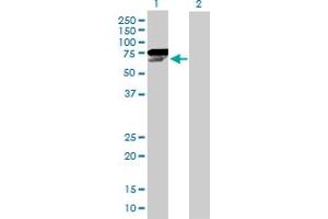 Western Blot analysis of CHEK2 expression in transfected 293T cell line by CHEK2 MaxPab polyclonal antibody.