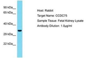 Image no. 1 for anti-Coiled-Coil Domain Containing 75 (CCDC75) (AA 36-85) antibody (ABIN6750780)