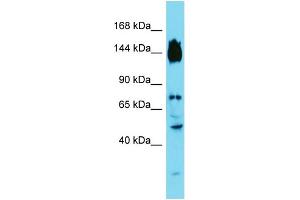 Image no. 1 for anti-Synapse Defective 1, rho GTPase, Homolog 2 (SYDE2) (C-Term) antibody (ABIN2791213)