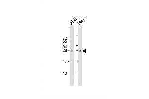 Image no. 4 for anti-Insulin-Like Growth Factor 2 (IGF2) (AA 39-68) antibody (ABIN650616)